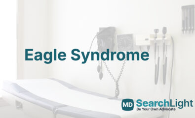 Eagle Syndrome