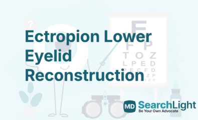 Ectropion Lower Eyelid Reconstruction