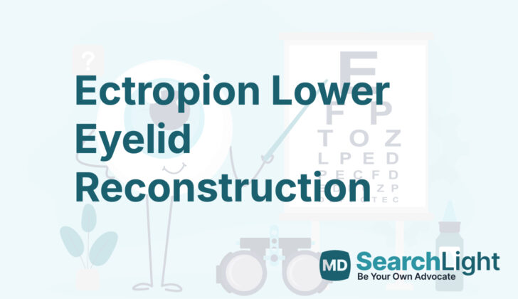 Ectropion Lower Eyelid Reconstruction