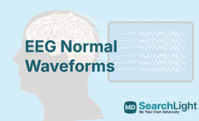 EEG Normal Waveforms