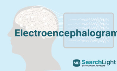 Electroencephalogram
