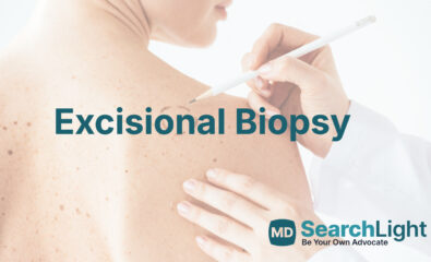 Excisional Biopsy