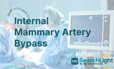 Internal Mammary Artery Bypass
