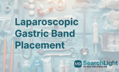 Laparoscopic Gastric Band Placement