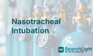 Nasotracheal Intubation