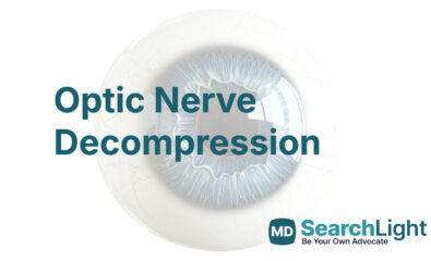 Optic Nerve Decompression
