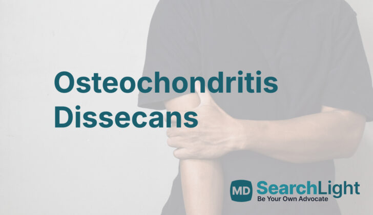 Osteochondritis Dissecans (osteochondral lesion)