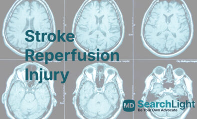 Stroke Reperfusion Injury