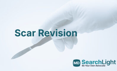 Scar Revision
