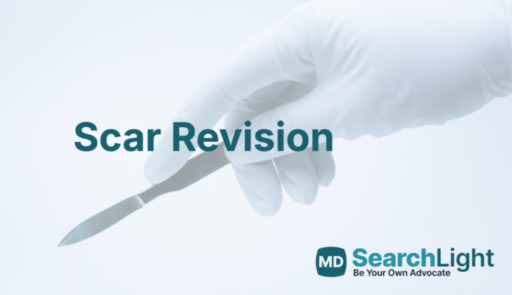 Scar Revision