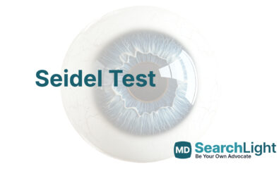 Seidel Test