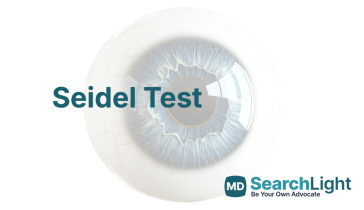 Seidel Test