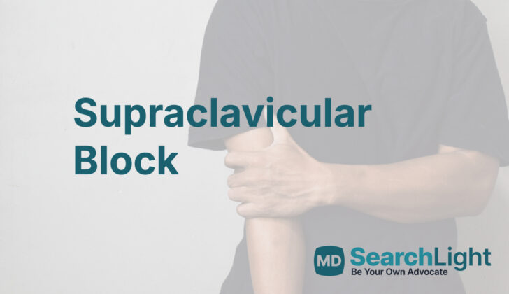 Supraclavicular Block