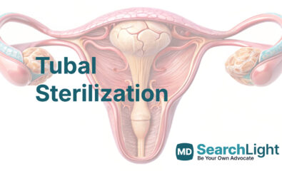 Tubal Sterilization