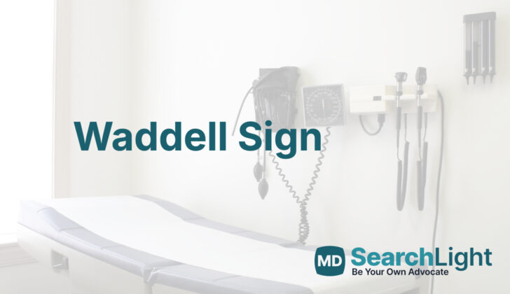 Waddell Sign