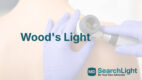 Wood's Light