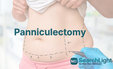 Panniculectomy