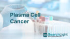 Plasma Cell Cancer