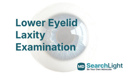 Lower Eyelid Laxity Examination