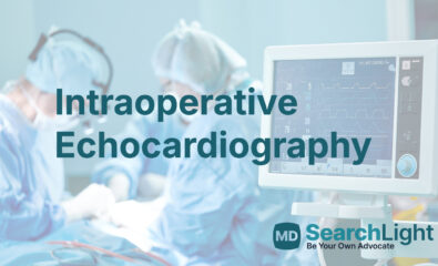 Intraoperative Echocardiography