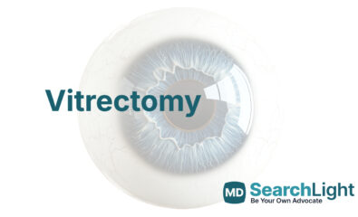 Vitrectomy