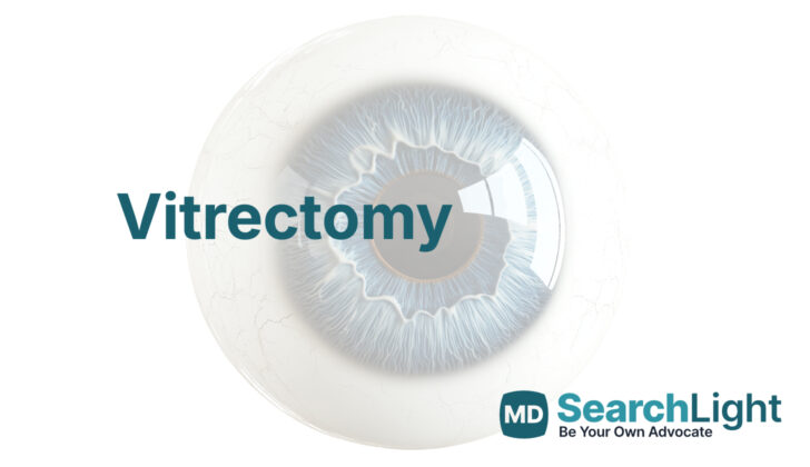 Vitrectomy
