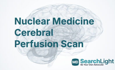 Nuclear Medicine Cerebral Perfusion Scan