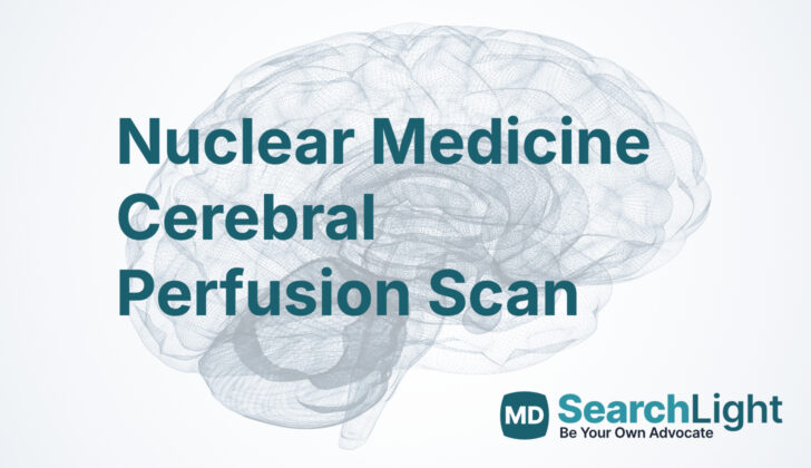 Nuclear Medicine Cerebral Perfusion Scan