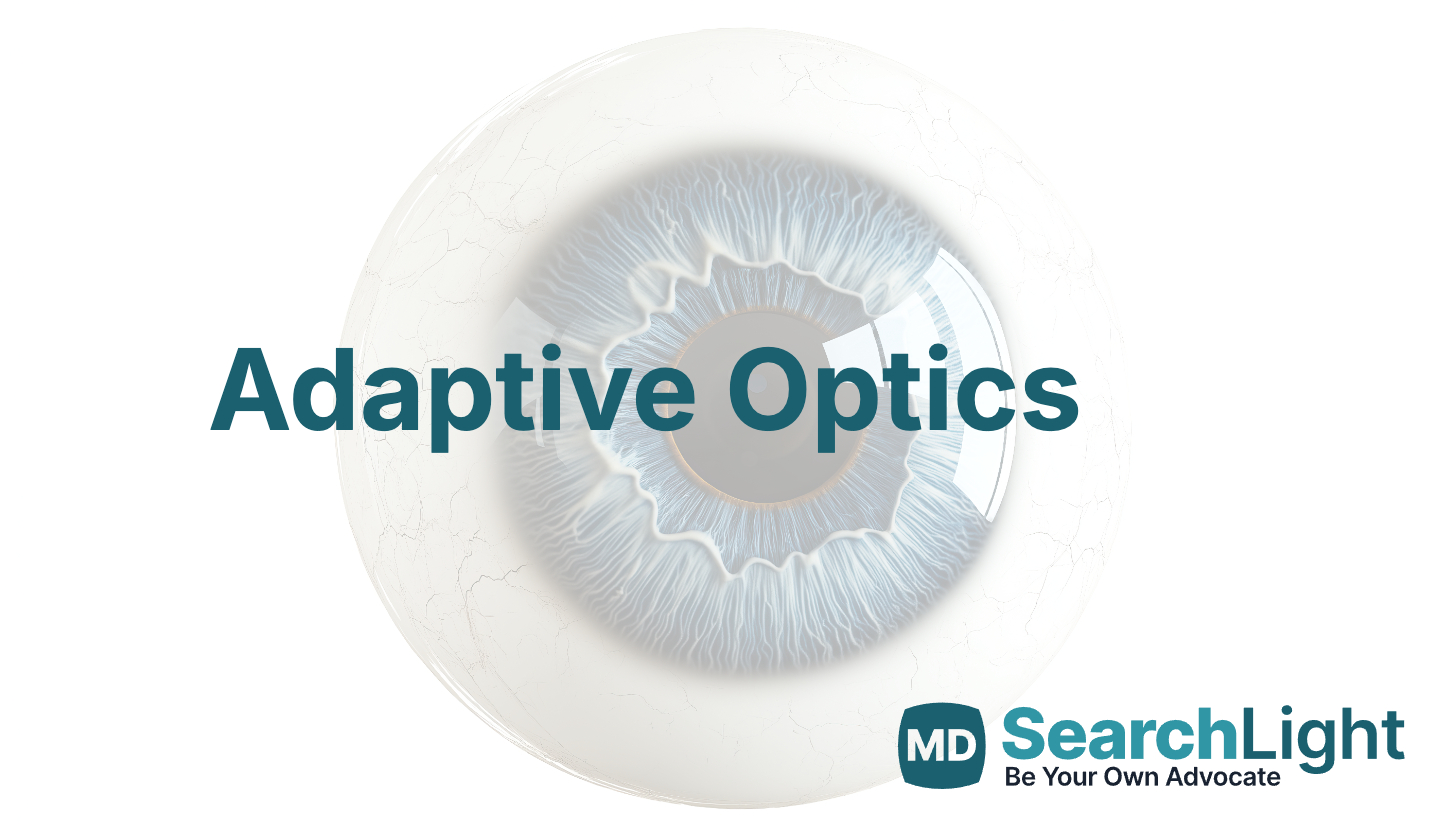 Adaptive Optics - MD Searchlight