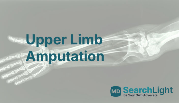 Upper Limb Amputation