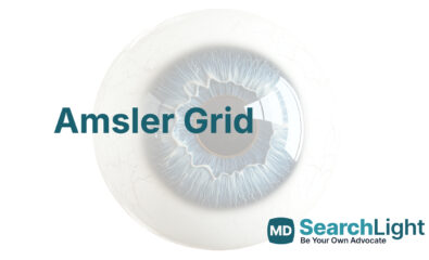 Amsler Grid