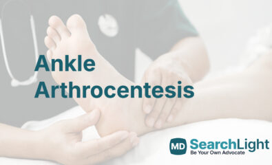 Ankle Arthrocentesis