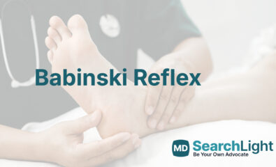 Babinski Reflex