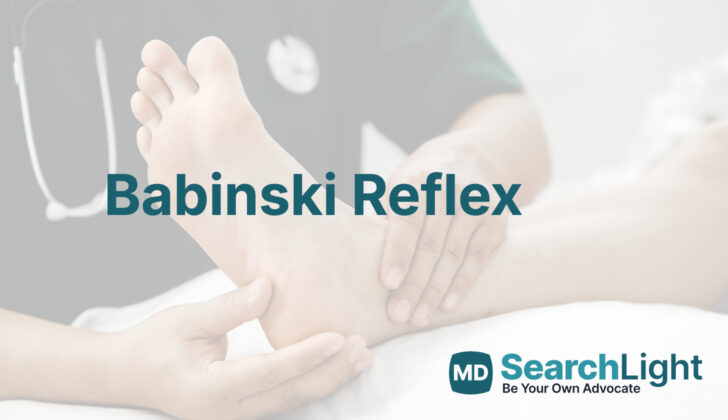 Babinski Reflex