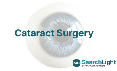 Cataract Surgery