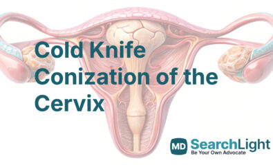 Cold Knife Conization of the Cervix