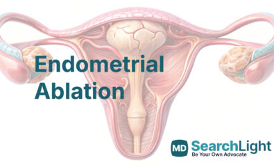 Endometrial Ablation