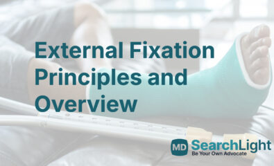 External Fixation Principles and Overview