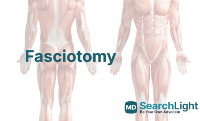 Fasciotomy