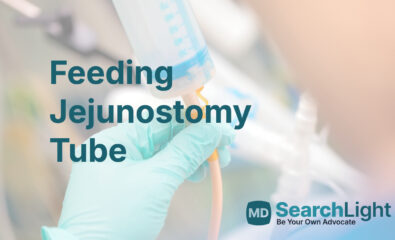 Feeding Jejunostomy Tube