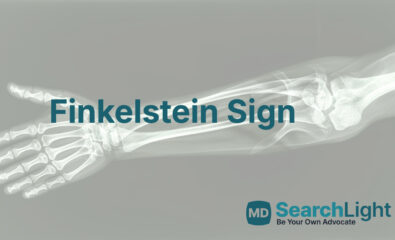 Finkelstein Sign