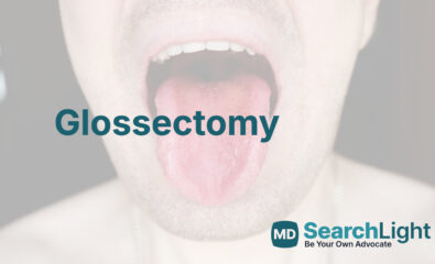 Glossectomy