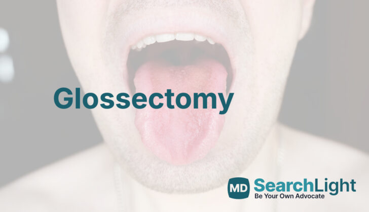 Glossectomy