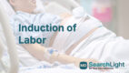 Induction of Labor