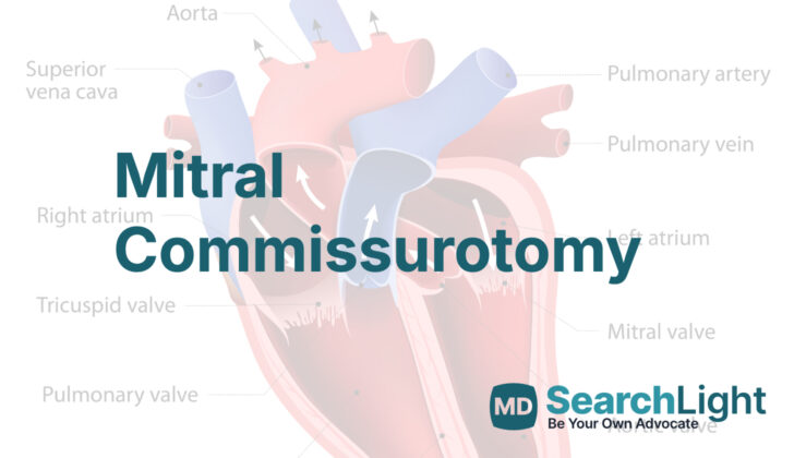 Mitral Commissurotomy