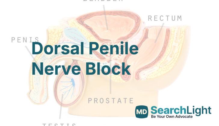 Dorsal Penile Nerve Block