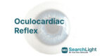 Oculocardiac Reflex