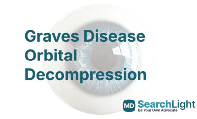 Graves Disease Orbital Decompression