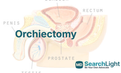 Orchiectomy