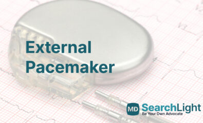 External Pacemaker